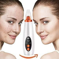 Electric Blackhead Remover Device