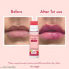 WishCare Tinted Ceramide Lip Balm with SPF50 PA+++ - Kojic Acid & Niacinamide - For Lip Lightening, Long Lasting Hydration - 5gm